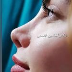 فوق تخصص جراحی زیبایی و بینی دکتر فتحی