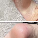 خدمات تخصصی پدیکور پا