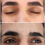 اصلاح تخصصی وترمیمی ابروی فرزانه