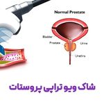 فیزیوتراپی تخصصی بابیمه /طرح رایگان