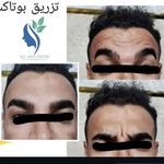 مطب زیبایی دکتر ملکی