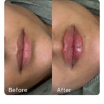مرکز پوست، مو، زیبایی و لیزر هُلو