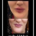 مرکزکلینیک لیزر زیبایی پوست و مو آسا