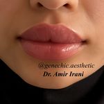 مطب پوست مو زیبایی و لاغری ژن شیک