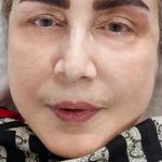 مرکز آرایش دائم وریموو وپوست گندم فلاحی