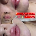 مرکز لیزر و کلینیک زیبایی پریفا