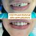 دندانپزشکی لبخند( بیمه نداریم)