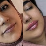 کلینیک زیبایی و لیزر دکتر آزاده اسماعیلی