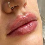 کلینیک زیبایی مرکز لیزر و لاغری زرین ماه