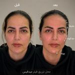 كلينيک زیبایی سانيل