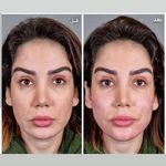 کلینیک پوست و زیبایی ژیلاوَش