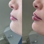 کلینیک تخصصی لیزر نوران