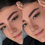میکروبلیدینگ میناسلمانی