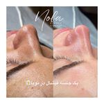 کلینیک زیبایی و لیزر مو زائد نوبا
