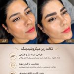 مرکز میکروبلیدینگ شیدینگ ریموو اسکالپ