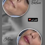 کلینیک زیبایی لاغری لیزر دانا