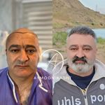 تخفیف ویژه بوتاکس پی ار پی مزوتراپی مزوژل لوکسیوا