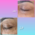 فیشال و پاکسازی پوست درنواب