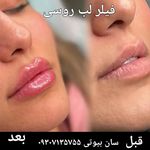 کلینیک زیبایی لیزر لاغری فشیال سان