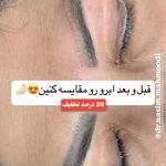 لیزر،پوست،مو(منطقه ۷ تهران)دکتر محمودی
