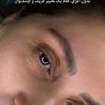 مرکز زیبایی عاطفه ترابی؛ فیبروز ابرو در اصفهان