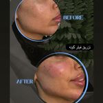 کلینیک زیبایی لاغری لیزر دانا