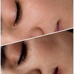 فیشیال / خدمات پوست / سالن زیبایی