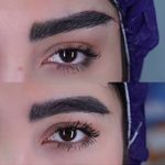 کلینیک زیبایی الماس کاملا اقساطی
