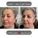 مرکز تخصصی فیشال و پاکسازی پوست فریما