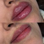 کلینیک پوست مو زیبایی و لیزر کهربا