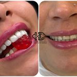 جراح و دندانپزشک زیبایی مهسا دلشاد