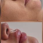 کلینیک هانیل | فیلر و بوتاکس شرق