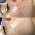 پاکسازی(فیشیال) وماساژصورت وبدن دریازارع