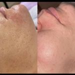 مرکز لیزر موهای زائد ماهور