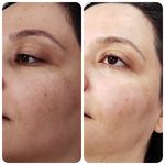 فیشیال / خدمات پوست / سالن زیبایی
