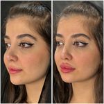 مجموعه لیزر و زیبایی کارنا(شاتی نداریم)