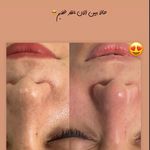 کلینیک فیشال و ماساژ سارن اسکین سارا