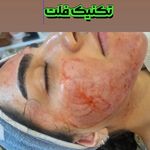 درمانگر پوست زهره مهرابی