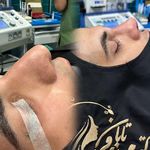 مطب زیبایی بینی و صورت دکتر تابان فر