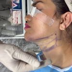 کلینیک زیبایی مرکز لیزر نورا