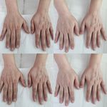 خدمات تخصصی پاکسازی پوست رویال اسکین