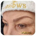 میکروبلیدینگ، آرایش دائم صورت، تتوبدن نشاط