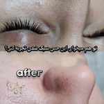 کلینیک زيبايي دلوين طهران