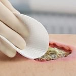 کلینیک درمان زخم نیک