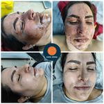 کلینیک درمان زخم نیک