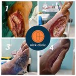 کلینیک درمان زخم نیک