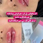 کلینیک زیبایی و لاغری  ایرانا