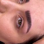 میکروبلیدینگ و تتو بدن