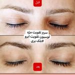 مشاوره پوست و مو (Plan Beauty)