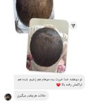 مشاوره پوست و مو (Plan Beauty)